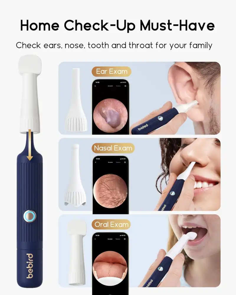 Bebird Earsight Plus I35R Ear Wax Removal Tool with Camera 2